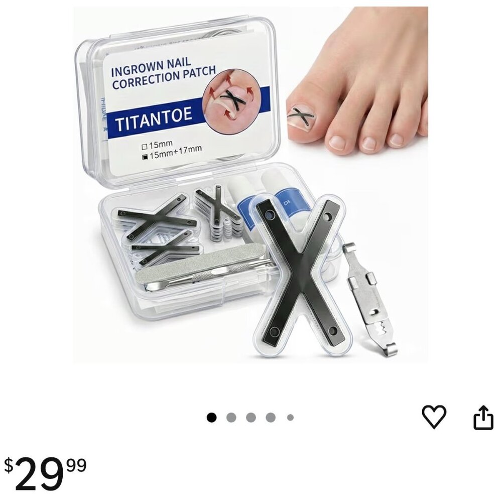 Ingrown Toenail Treatment Corrector Strips, Titanium Alloy Ingrown Nail Curve Co